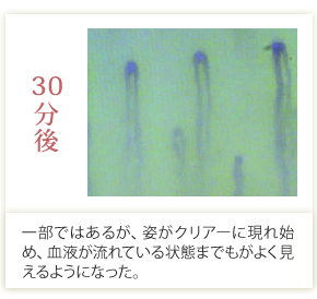 血流顕微鏡での観察結果